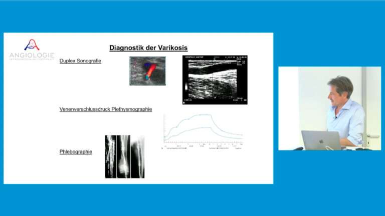 CME Webinar
